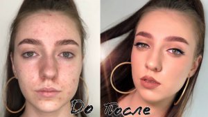 МАКИЯЖ ДЛЯ ПРОБЛЕМНОЙ КОЖИ. Как скрыть прыщи и постакне. Урок ИДЕАЛЬНЫЕ СТРЕЛКИ.