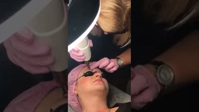 Удаление лазером Студия Татуажа смотреть онлайн