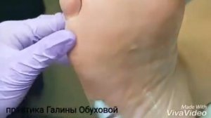 В кабинете подолога, работа аппаратом со спреем !