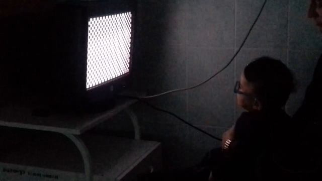 Глубоко недоношенный  / ЭФИ (Зрительные вызванные потенциалы)