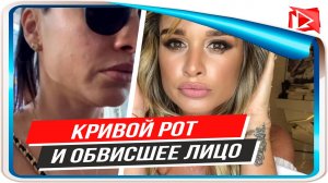 У Ксении Бородиной «слетел» фильтр показав обвисшее лицо