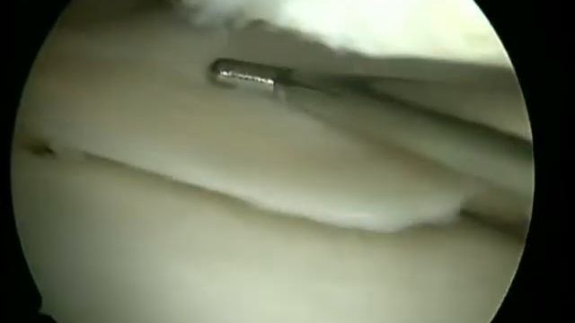 Лазишвили Гурам Давидович смотреть онлайн