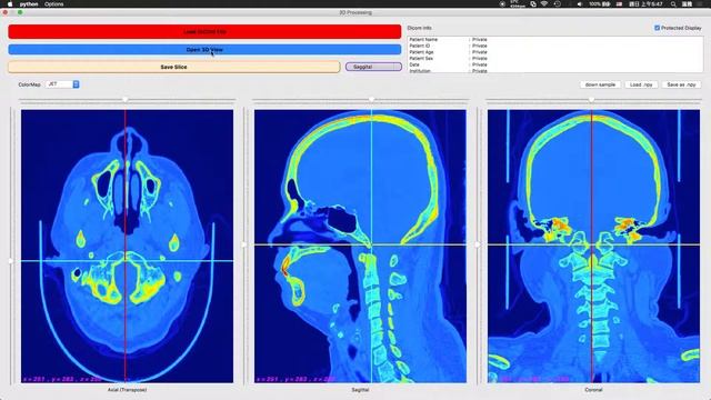Dicom Viewer Project – 3D Processing Demo смотреть онлайн