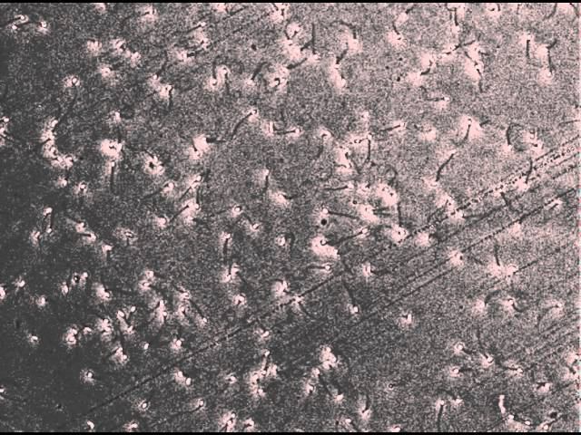 Подвижность сперматозоидов смотреть онлайн