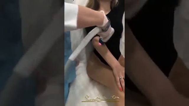 Лазерная эпиляция рук