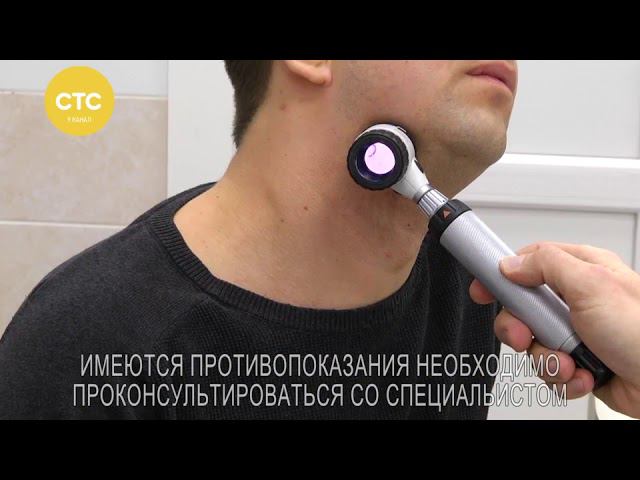 Приём дерматолога и удаление новообразований кожи смотреть онлайн