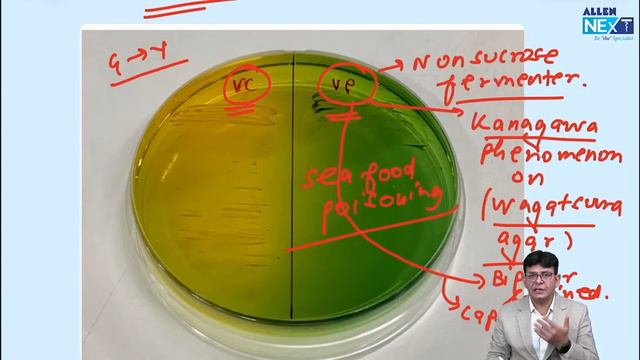 Vibrio cholerae Important points смотреть онлайн