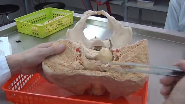 Женская половая система. Анатомический препарат: комплекс органов малого таза смотреть онлайн