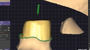Одиночная коронка в exocad от А до Я. Спец выпуск.