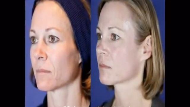 Mixto Waiting Room Video by Lasering смотреть онлайн