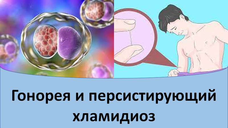 Гонорея и персистирующий хламидиоз смотреть онлайн