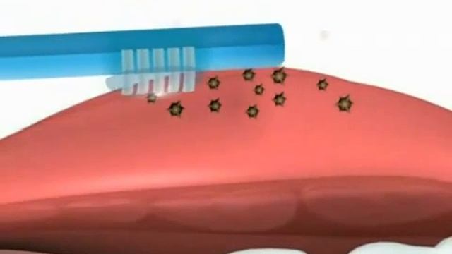 Miradent Tong-Clin Set смотреть онлайн