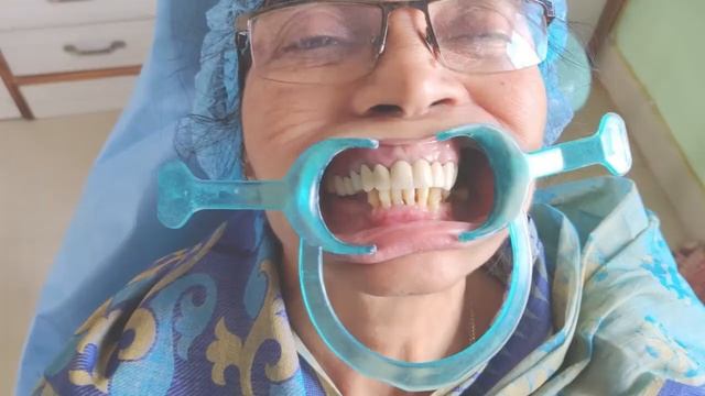 Best dental clinic in Bhubaneswar | Dazzle Dental Care смотреть онлайн