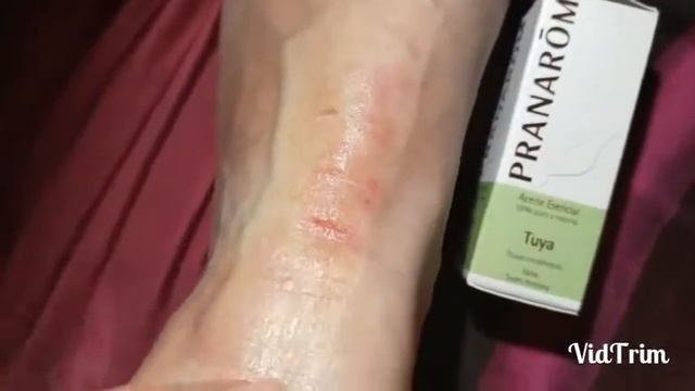 Лечимся как можем... я нашла как! смотреть онлайн