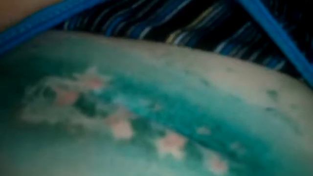 Мне удаляли апендицыт смотреть онлайн