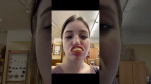 Наглядное видео как заживают губы 👄 после увеличения