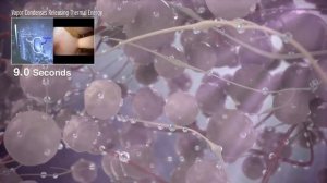 Лечение гиперплазии предстательной железы ДГПЖ в Израиле. Удаление аденомы простаты Rezum за рубежом