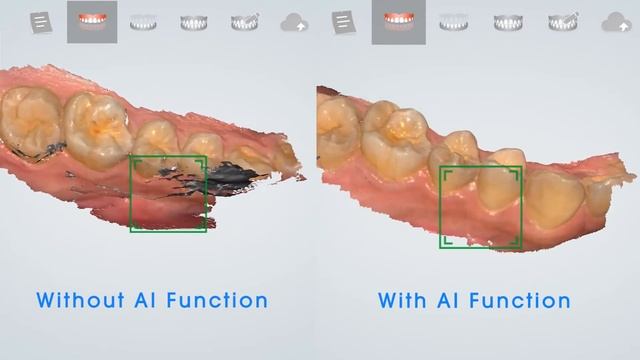 Aoralscan - AI Function смотреть онлайн