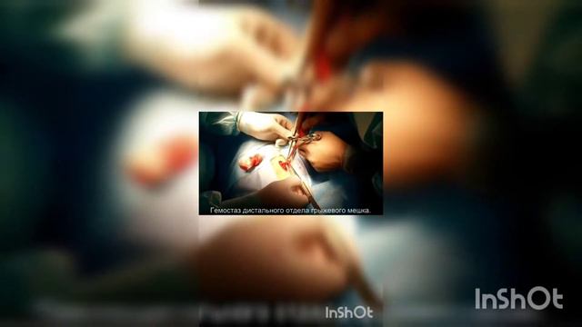 InShot 20190406 220347736 смотреть онлайн
