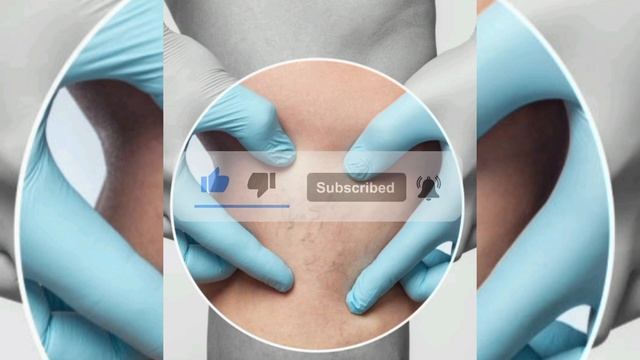 Отёк ног По Ночам или по Утрам , причина и лечение #отёкног #отёкпричина #отёк