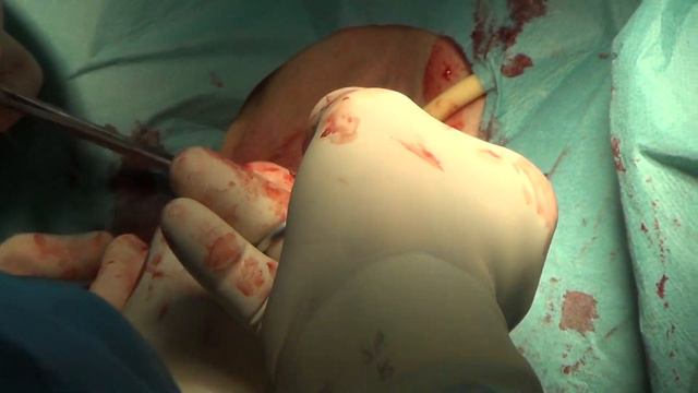 CYSTO-SWING Novosibirsk