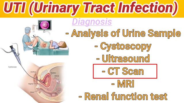 UTI | Urinary Tract Infection Treatment/Symptoms/Causes/Diagnosis | पेशाब की नली मैं इंफेक्शन | смотреть онлайн