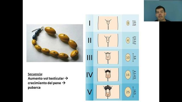 Pubertad Normal (3° Parte) смотреть онлайн