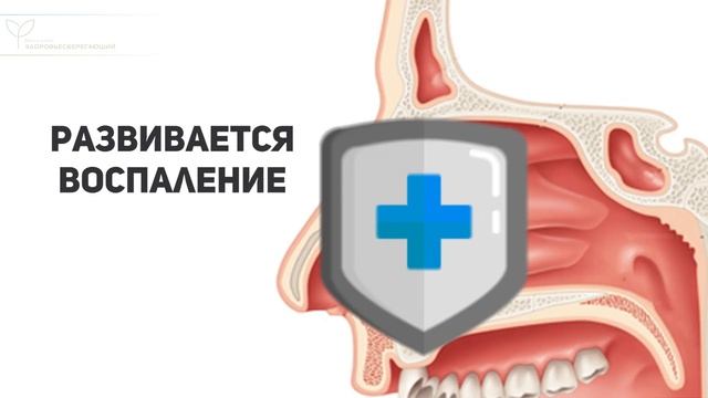 Что происходит, когда заложен нос или откуда берется насморк смотреть онлайн