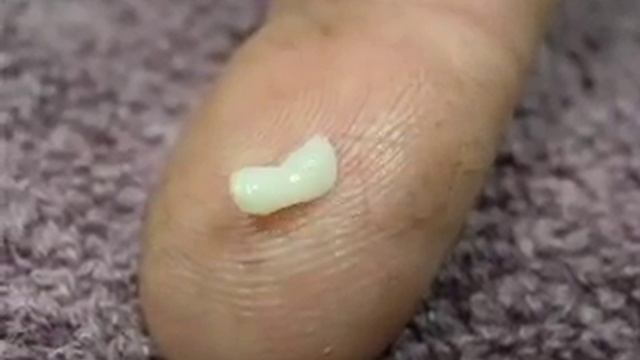 Tapeworm segment смотреть онлайн
