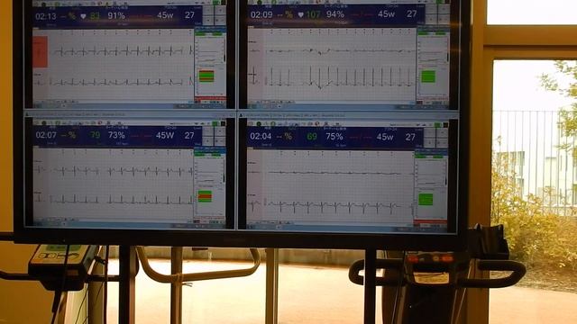 6 beds 12 leads Cardiac Stress System with Central Monitor смотреть онлайн