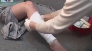 Правила наложения бинтовых повязок на рану