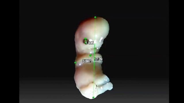 эмбрион человека в 3D