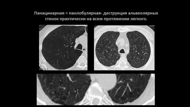 Лукина О.В.«Стандарты диагностики ХОБЛ» смотреть онлайн
