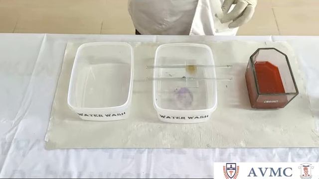 Unlocking the Secrets of Perls Prussian Blue Stain: The Ultimate Tool for Iron Staining смотреть онлайн