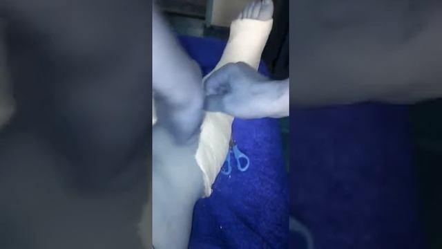 Как снимать гипс дома???? смотреть онлайн