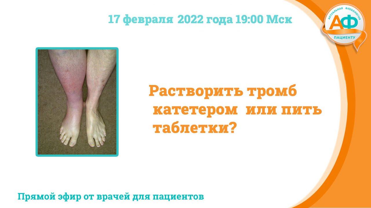 Растворить тромб катетером или пить таблетки?