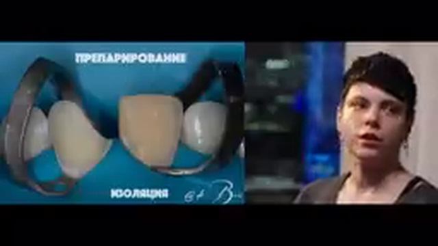 Мария Бессонова - Сложный кейс | Реставрации на микроскопе | Композитные виниры смотреть онлайн