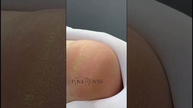 МК обработка пяток на косметике PinkRoyss #педикюр #ноги #пятки #pinkroyss #педикюрпушкин #мкпедикю смотреть онлайн