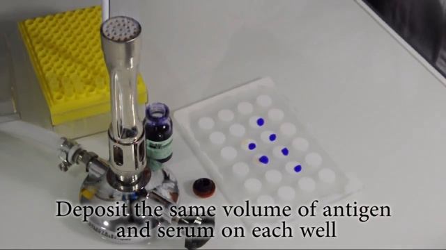 How to perform a Rapid Slide Agglutination Test смотреть онлайн
