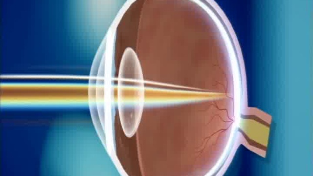 Мифы, в которые верят даже врачи смотреть онлайн