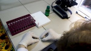 Подсчет лейкоцитарной формулы на мазках крови