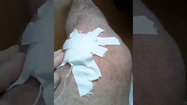 артроз .обезболивание постоянным током смотреть онлайн