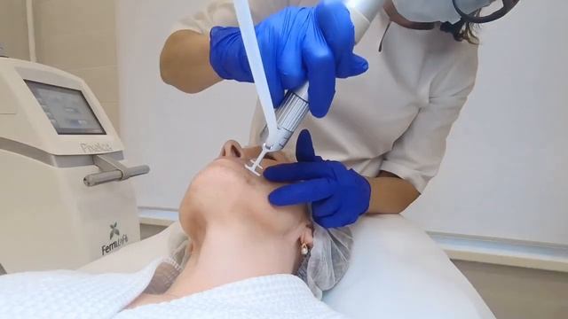 ГЛУБОКАЯ ЛАЗЕРНАЯ ШЛИФОВКА NANO PIXEL CO₂ Сеть клиник косметологии GEN87 смотреть онлайн