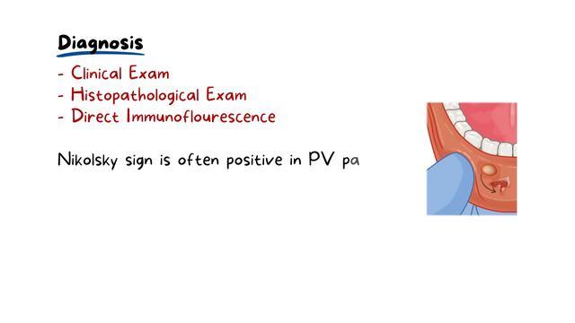 Pemphigus Vulgaris: Oral Cavity Symptoms and Treatment смотреть онлайн