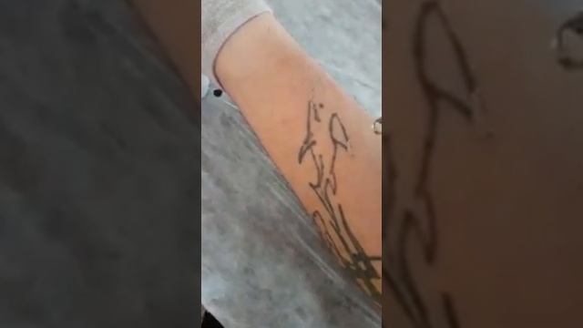 Лазерное удаление татуировки. смотреть онлайн