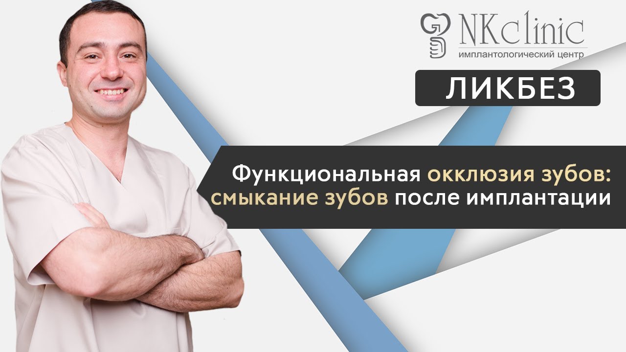 Функциональная окклюзия зубов: смыкание зубов после имплантации | Блог #8 | NKClinic