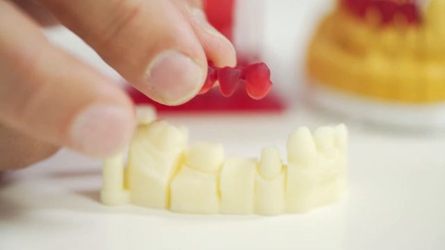 3D Printing in the Dental Laboratory: using precision casting technology with Freeprint® cast смотреть онлайн