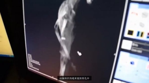 The Atacama Humanoid  Mystery   Part 2