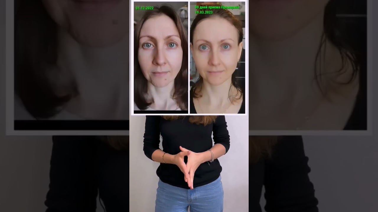 Коллаген. Как правильно выбрать коллаген. смотреть онлайн