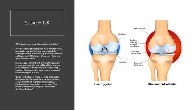 Serrapeptase Testimonials 2019